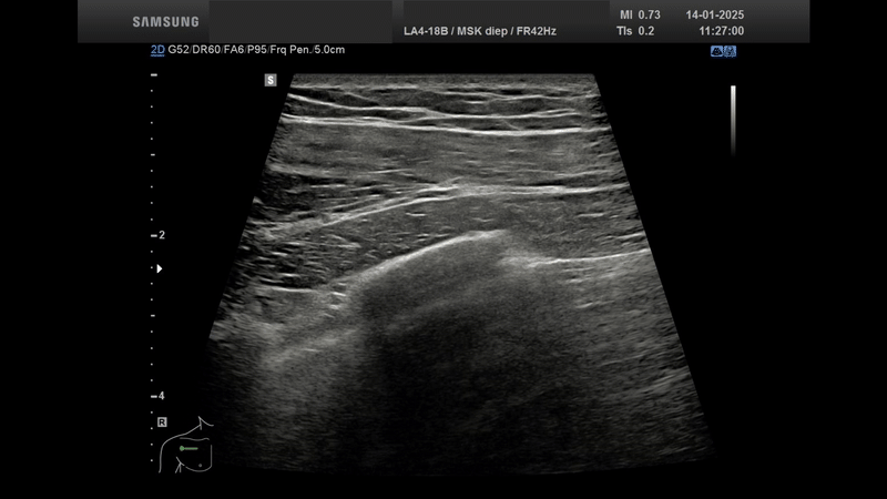 ezgif 6b0a8f2aab1f49