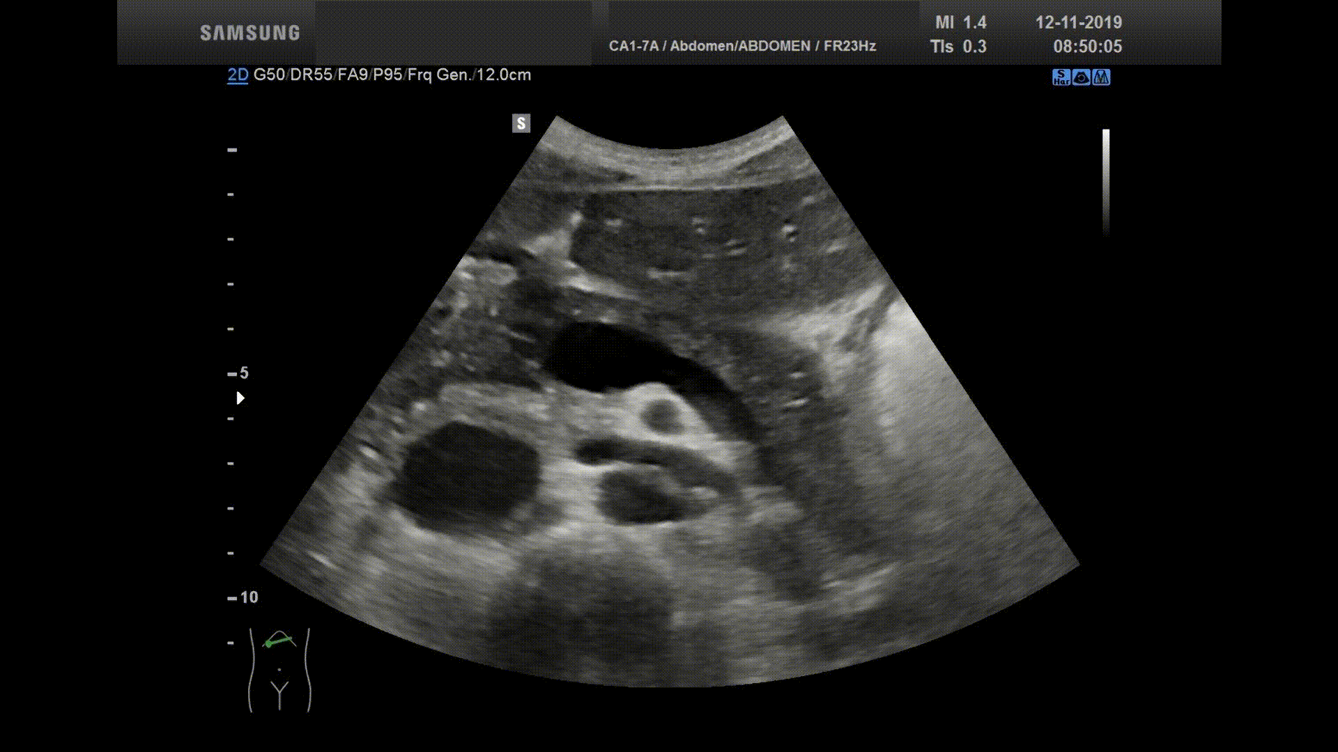 Promo portale hypertensie